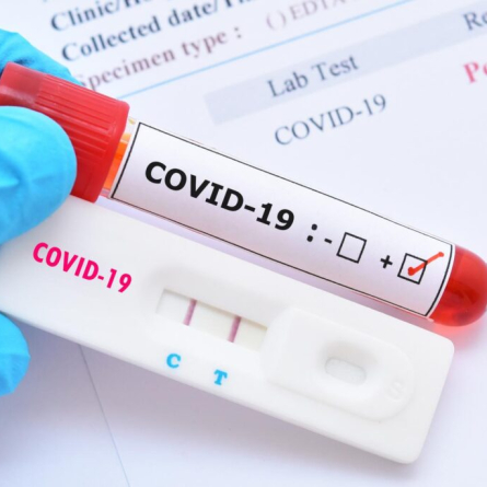 COVID19: Rapid Antigen Test ή PCR Test για Διάγνωση;